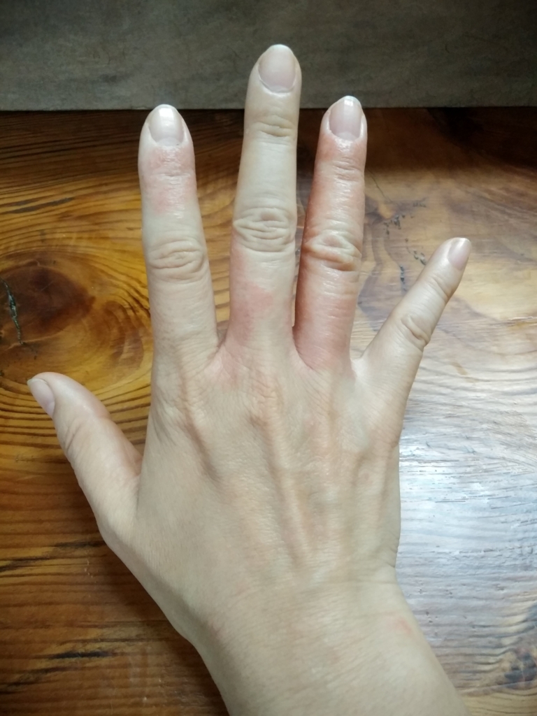 f:id:edamaruko:20180522000730j:plain f:id:edamaruko:20180522000730j:plain