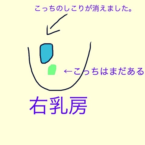 f:id:egao700:20180224000605j:image f:id:egao700:20180224000605j:image