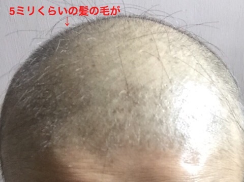 f:id:egao700:20180624194715j:image f:id:egao700:20180624194715j:image