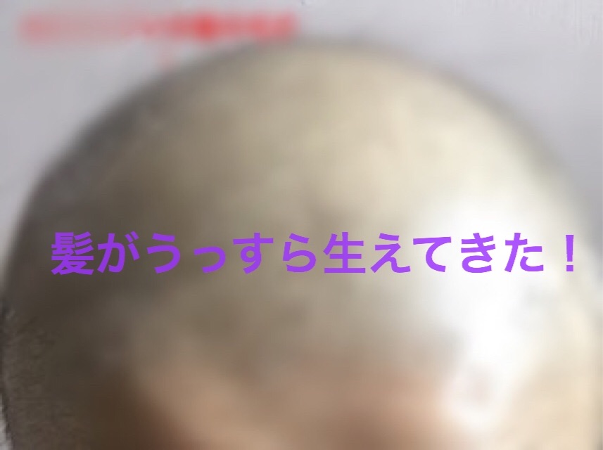 f:id:egao700:20180624200149j:image f:id:egao700:20180624200149j:image