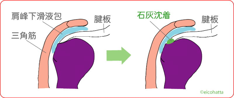 f:id:eigon:20140911094451g:image