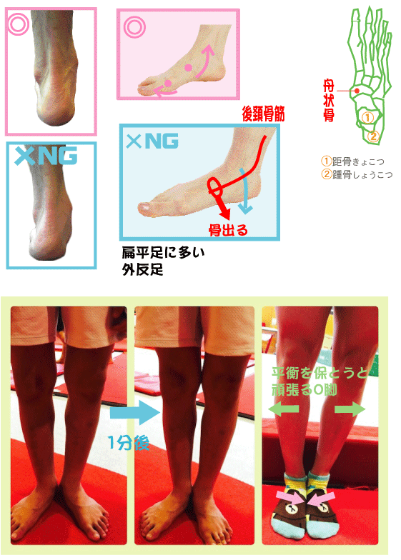 f:id:eigon:20170211074250g:image
