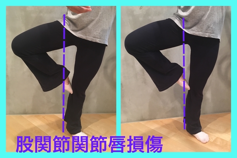 f:id:eigon:20180910145501j:image
