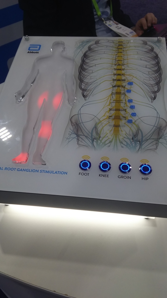 f:id:eitaro-torii-exwzd:20190111183902j:plain