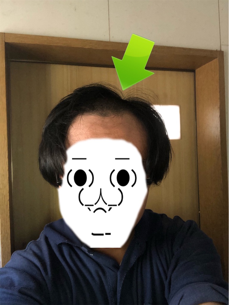 f:id:eiyu123:20201123223608j:image