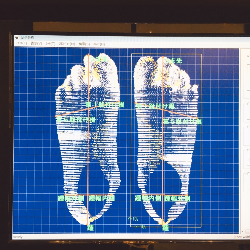 f:id:electricshock:20180402125518j:plain