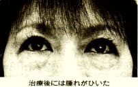 治療後の池田さん