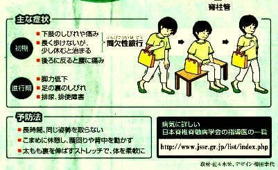 腰部脊柱管狭窄症の症状&予防法