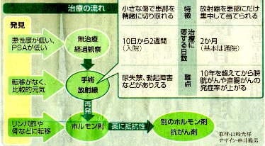 前立腺がんの治療の流れ