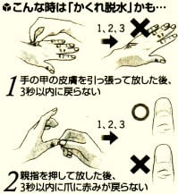 かくれ脱水の簡単な検査方法イラスト