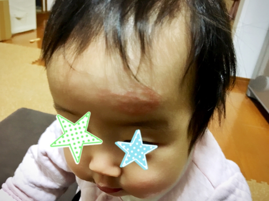 f:id:elly-m:20171201204555j:plain f:id:elly-m:20171201204555j:plain