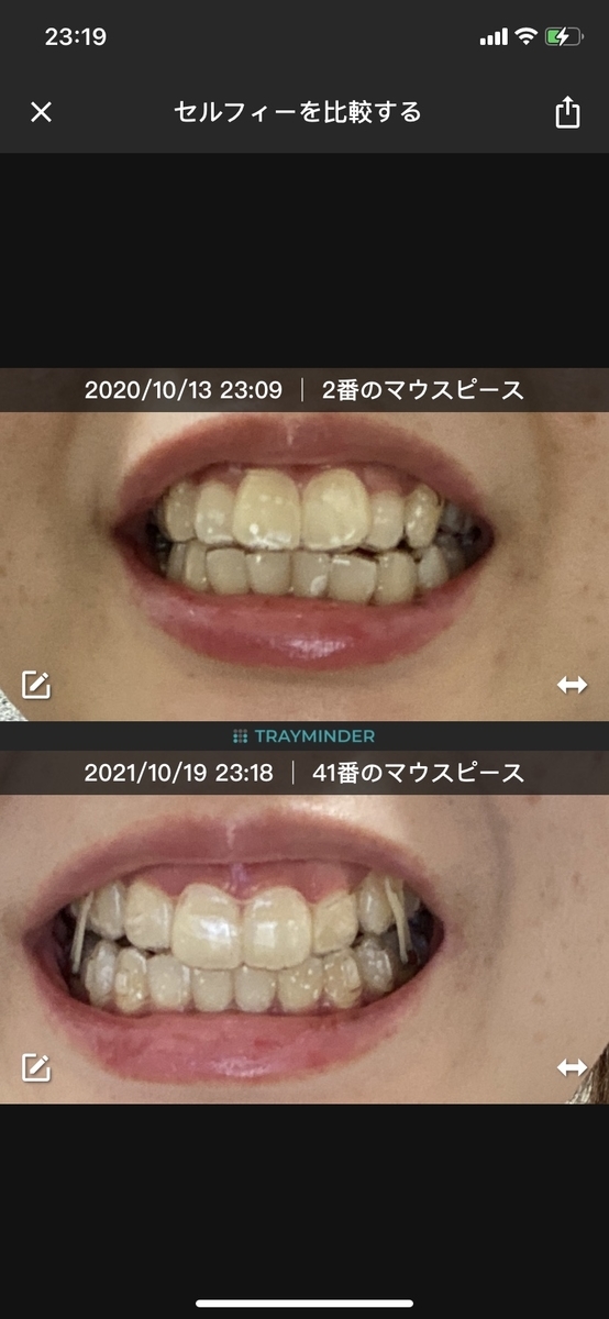 f:id:elsa0105:20211024112219j:plain