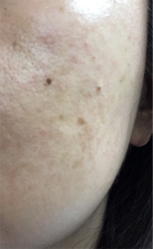 f:id:elve:20161101235045j:image:w150