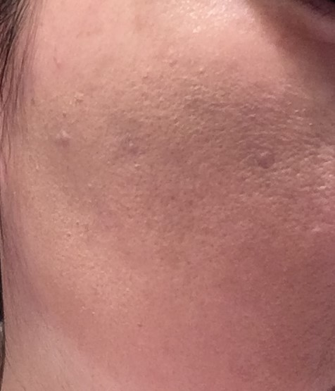 f:id:elve:20190309094041j:plain f:id:elve:20190309094041j:plain