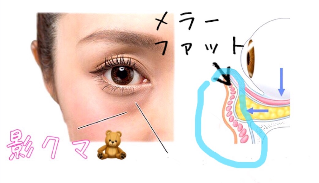 f:id:emiliaikemu4649:20200316000918j:image f:id:emiliaikemu4649:20200316000918j:image