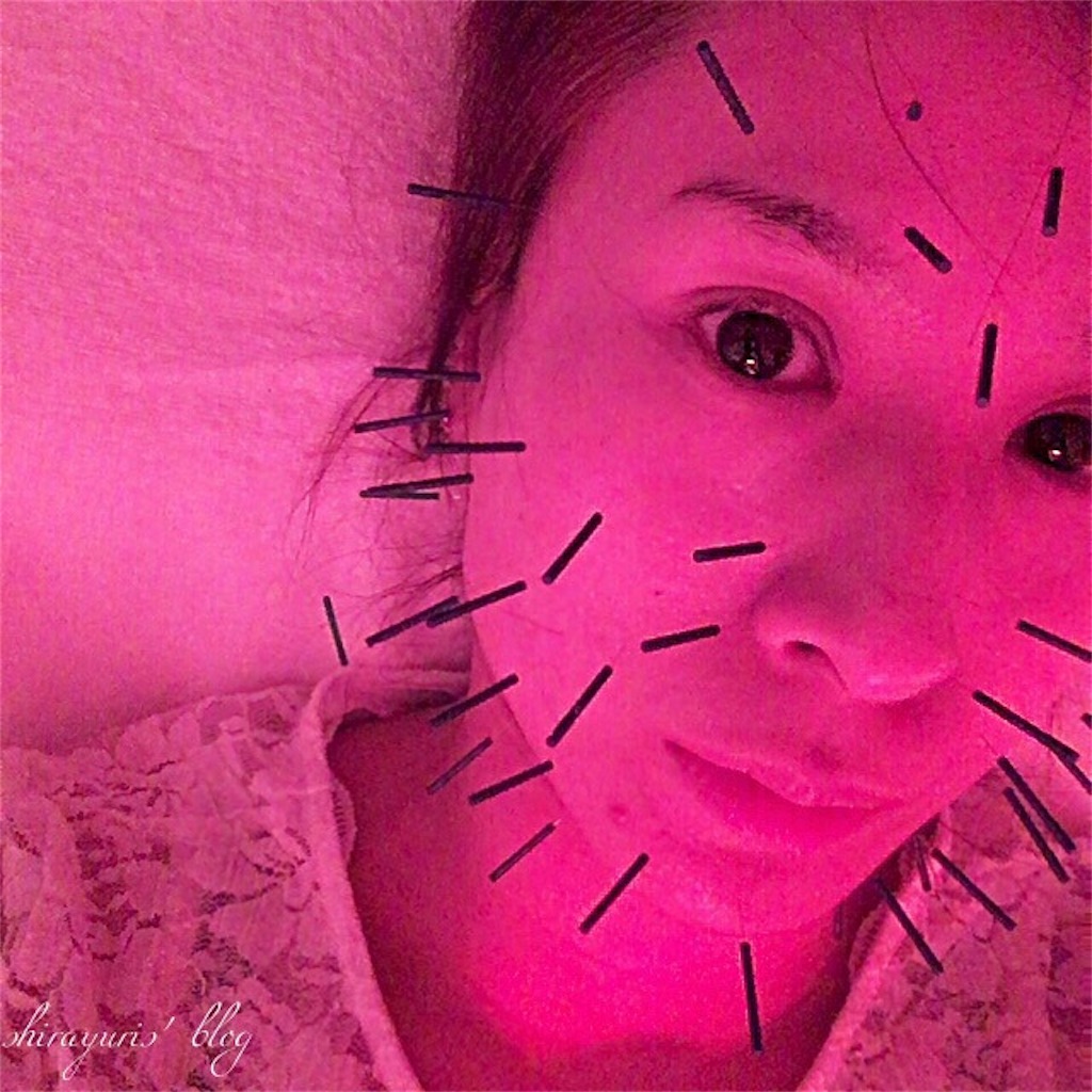 f:id:emiliaikemu4649:20200401034551j:image