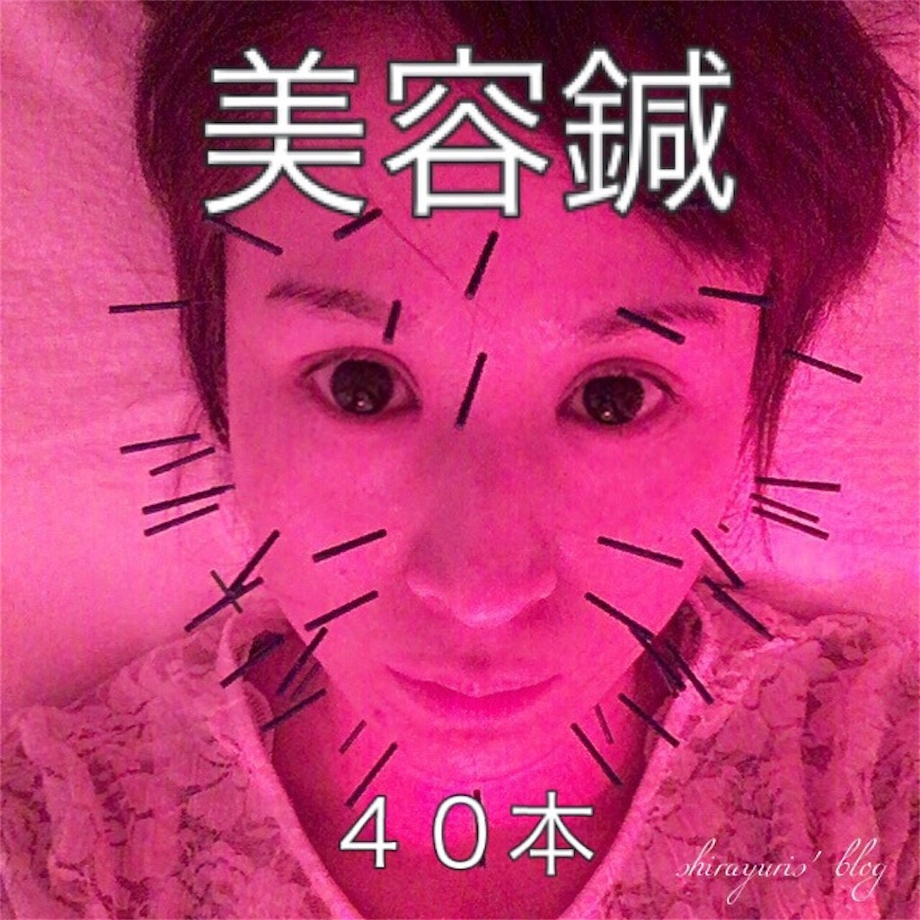 f:id:emiliaikemu4649:20200401034557j:image