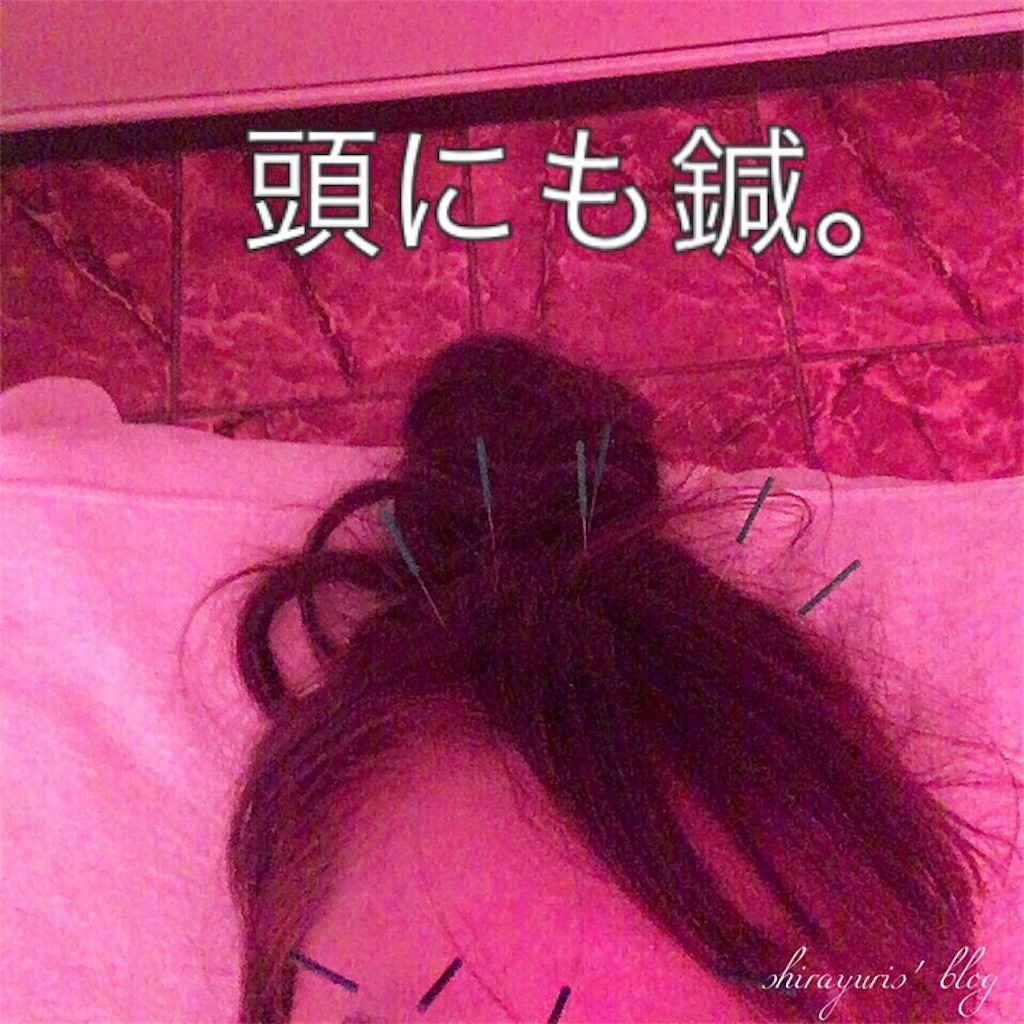 f:id:emiliaikemu4649:20200401034606j:image