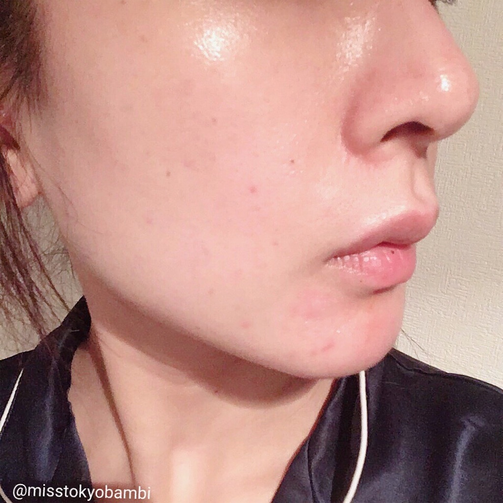 f:id:emiliaikemu4649:20200614220651j:image
