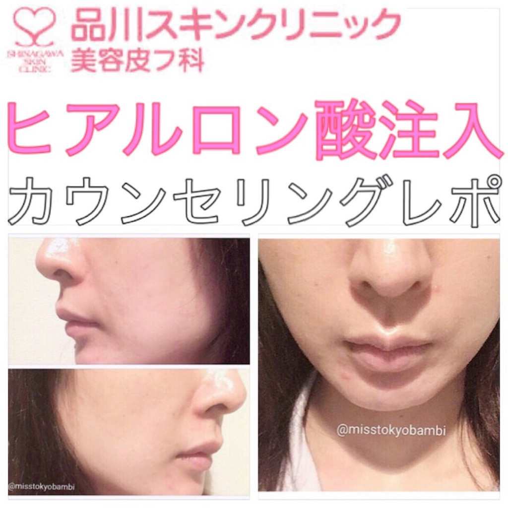 f:id:emiliaikemu4649:20200930201543j:plain f:id:emiliaikemu4649:20200930201543j:plain