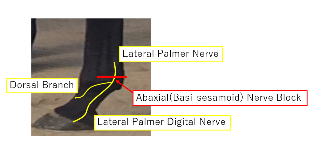 abaxial nerve block