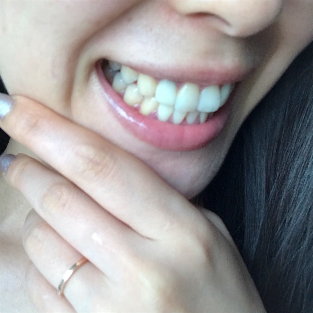 f:id:erika0706:20190204162125j:image
