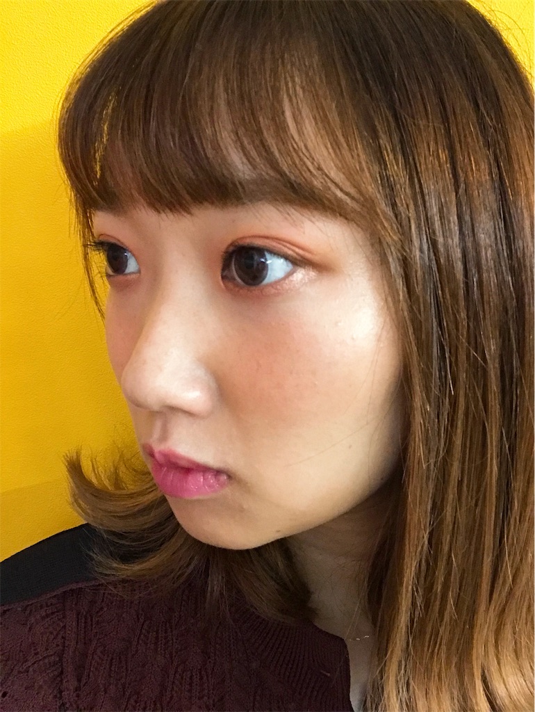 f:id:erikamd:20191203213518j:image f:id:erikamd:20191203213518j:image