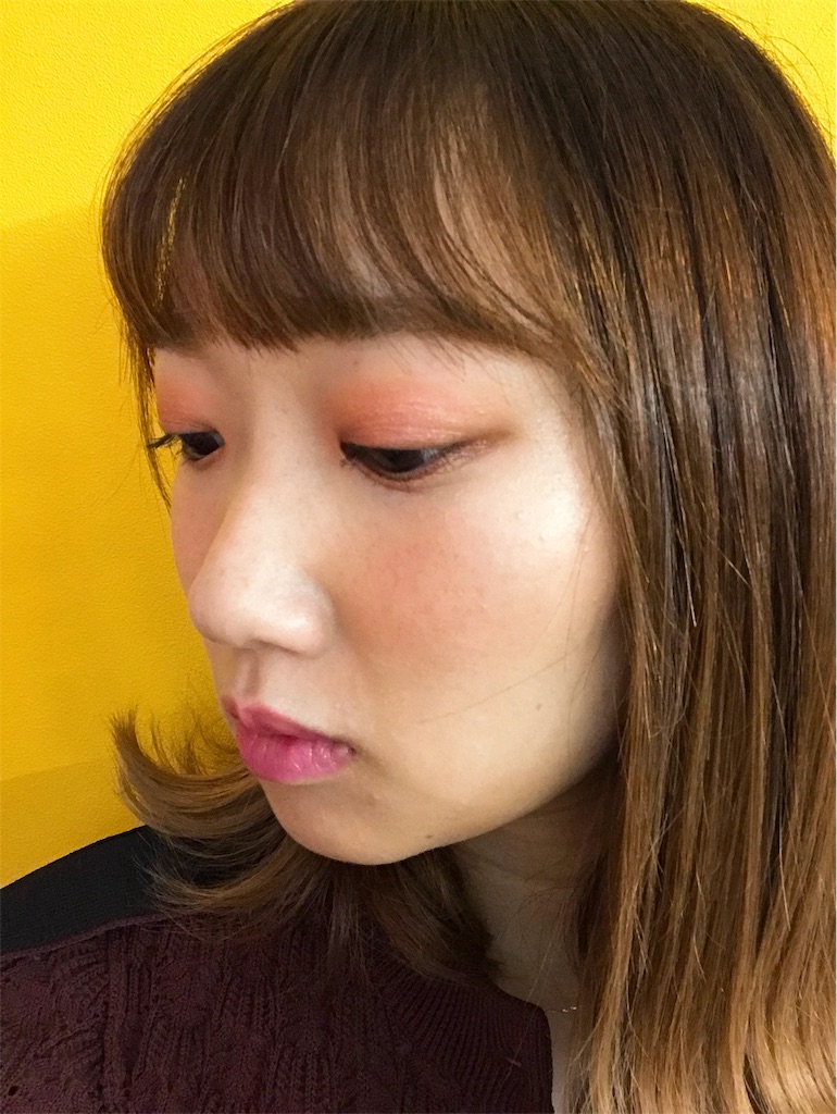 f:id:erikamd:20191203213521j:image f:id:erikamd:20191203213521j:image