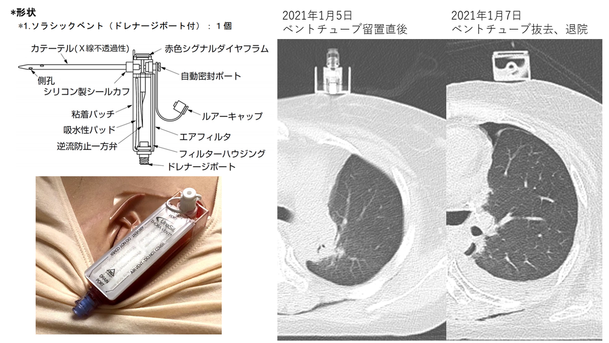 f:id:erikospassion:20210321154729p:plain