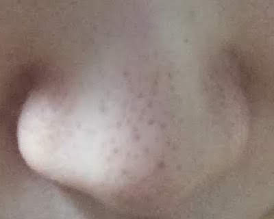 f:id:espskinner:20180613170213j:plain