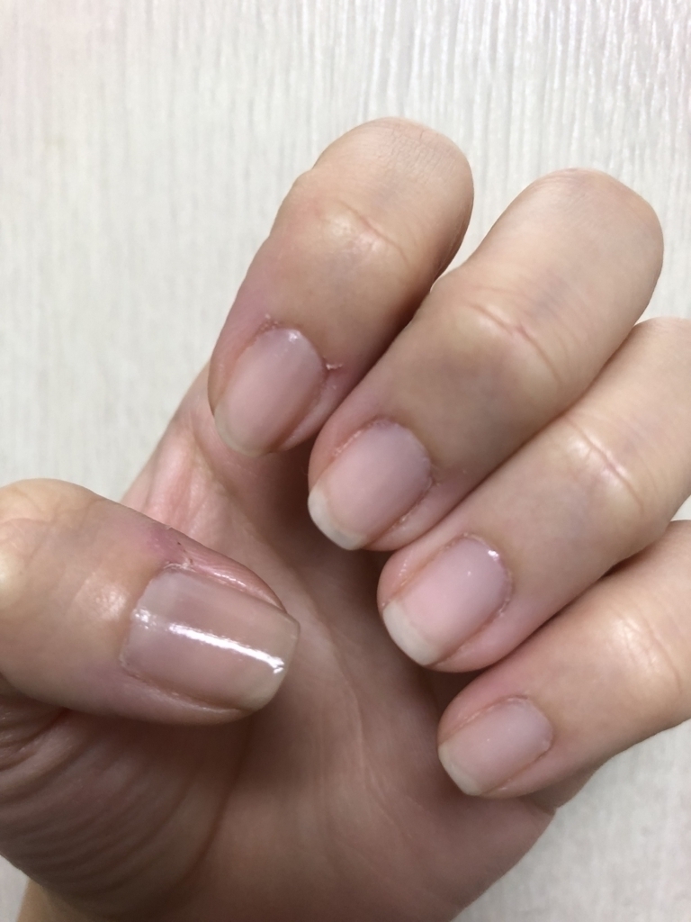 悪癖をお金払って矯正した話 抜け殻の極み
