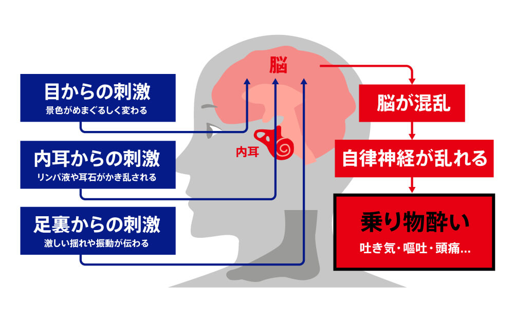 〈図〉乗り物酔いのメカニズム（イメージ）