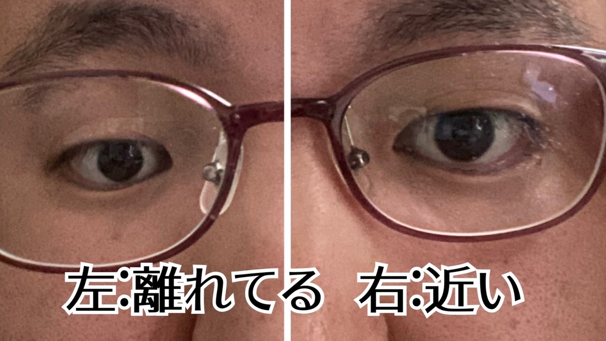 f:id:eyevisionsupport:20220414131350j:plain