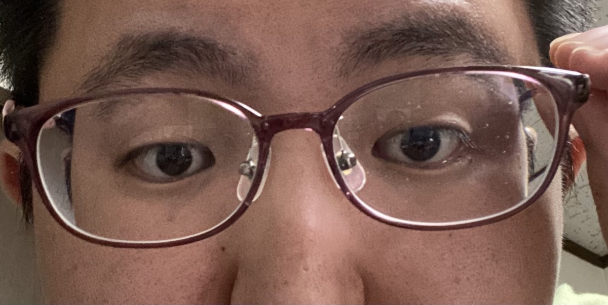 f:id:eyevisionsupport:20220414131355j:plain