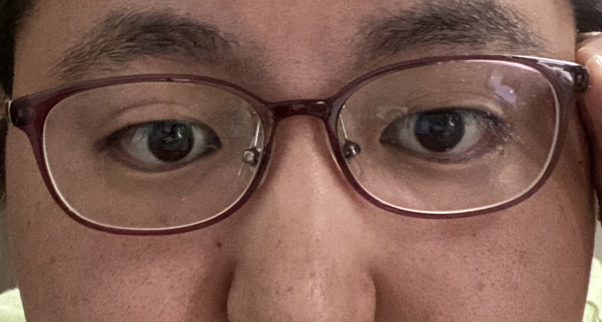 f:id:eyevisionsupport:20220414131401j:plain