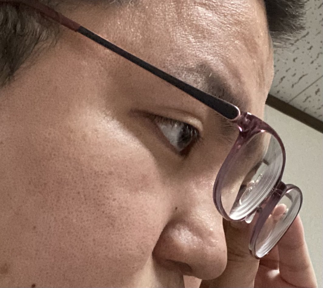 f:id:eyevisionsupport:20220414131405j:plain