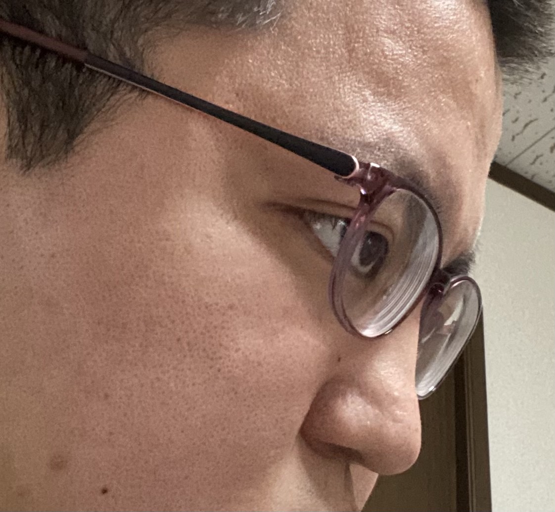 f:id:eyevisionsupport:20220414131410j:plain