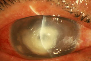 f:id:f-eye:20131015185823j:image