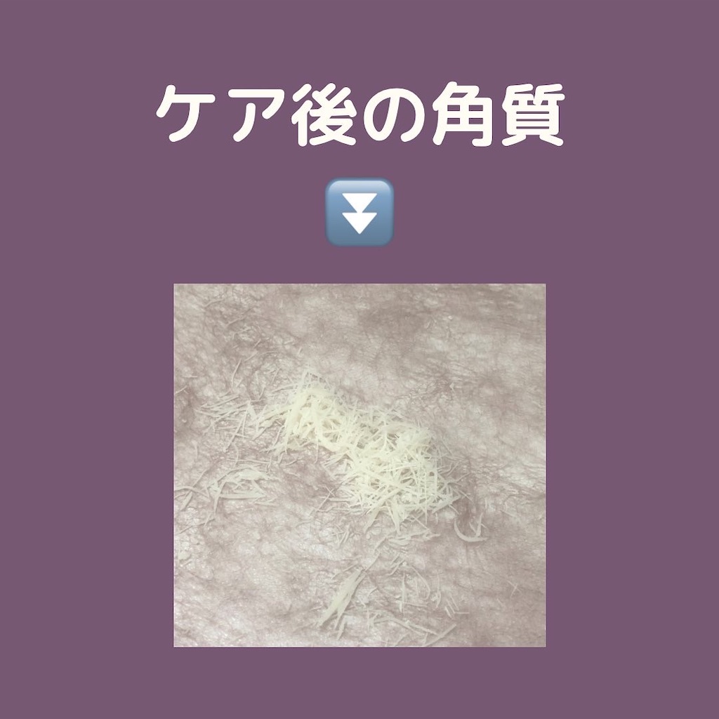 f:id:f_jasmine:20220526120622j:image f:id:f_jasmine:20220526120622j:image