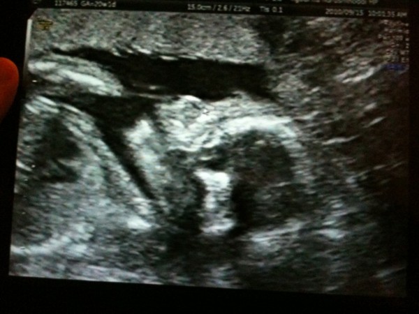 f:id:fantasticfuture:20100918012307j:image
