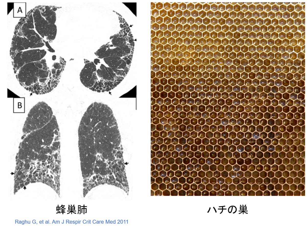 医師の診察を受ける時期
