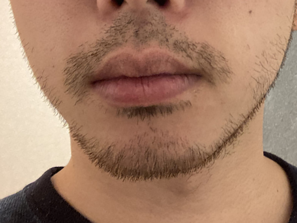 f:id:firon_52:20210103143242j:plain