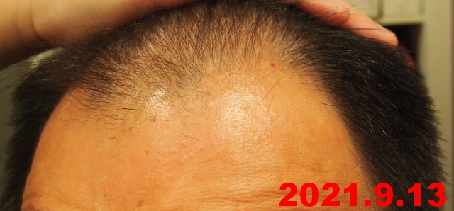 f:id:fleurdulapin:20210913214110j:plain