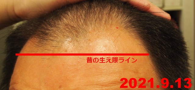 f:id:fleurdulapin:20210913214117j:plain