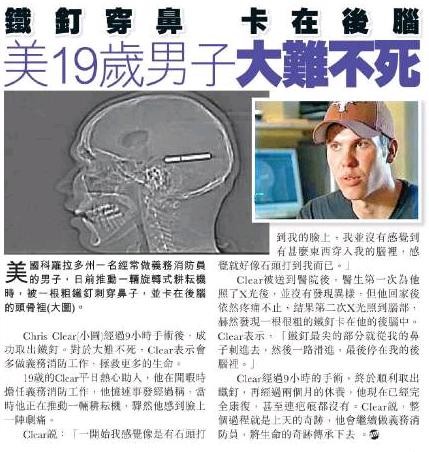 f:id:flexiblefish:20080711111934j:image
