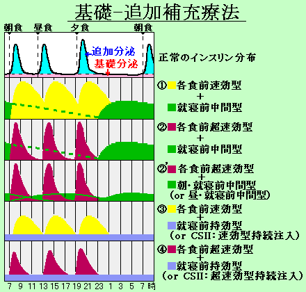 基礎基礎インスリンと追加インスリンの組み合わせのバリエーションを示した図