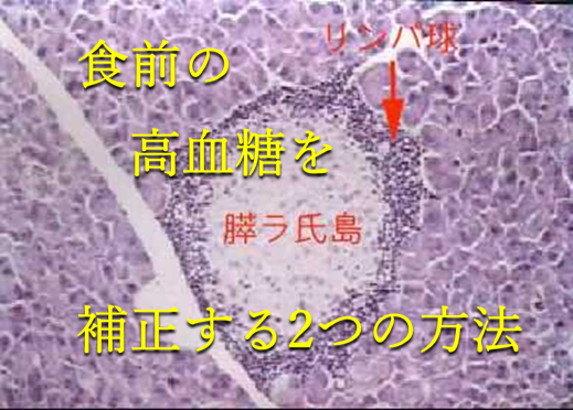 食前の高血糖を補正する2つの方法 膵臓ランゲルハンス島の細胞をリンパ球が攻撃しているところの顕微鏡写真