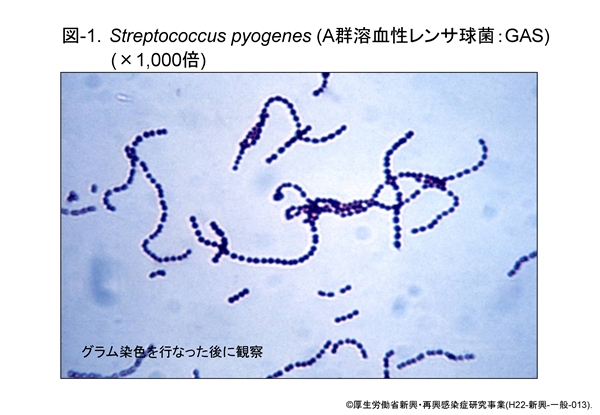 グラム染色を行ったA群溶血性レンサ球菌の顕微鏡写真