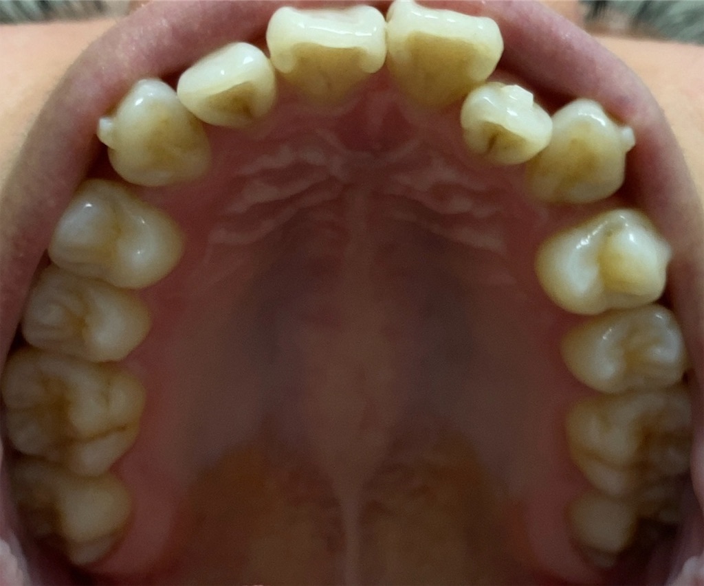 f:id:fmdesign:20200617093946j:image f:id:fmdesign:20200617093946j:image