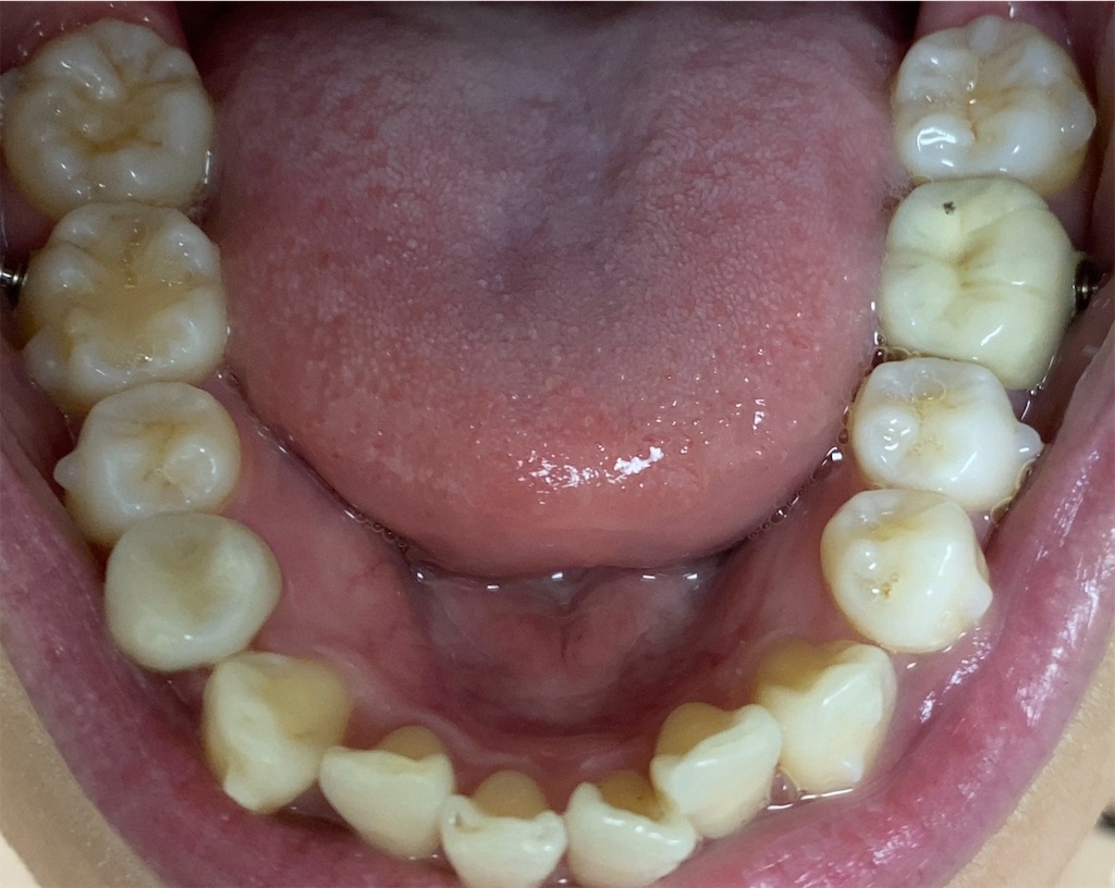 f:id:fmdesign:20200617093950j:image f:id:fmdesign:20200617093950j:image